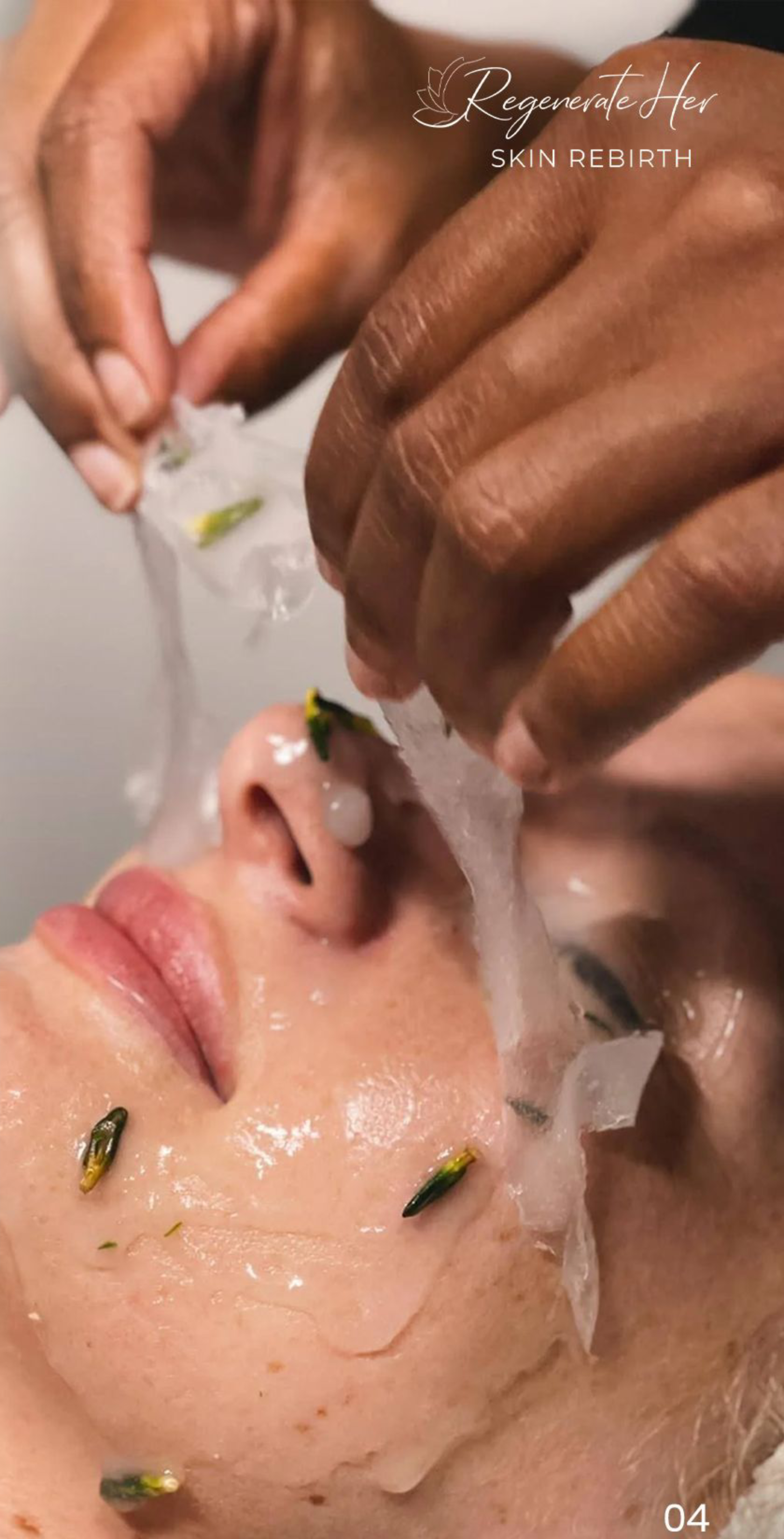 Regenerate Her — Skin Rebirth treatment